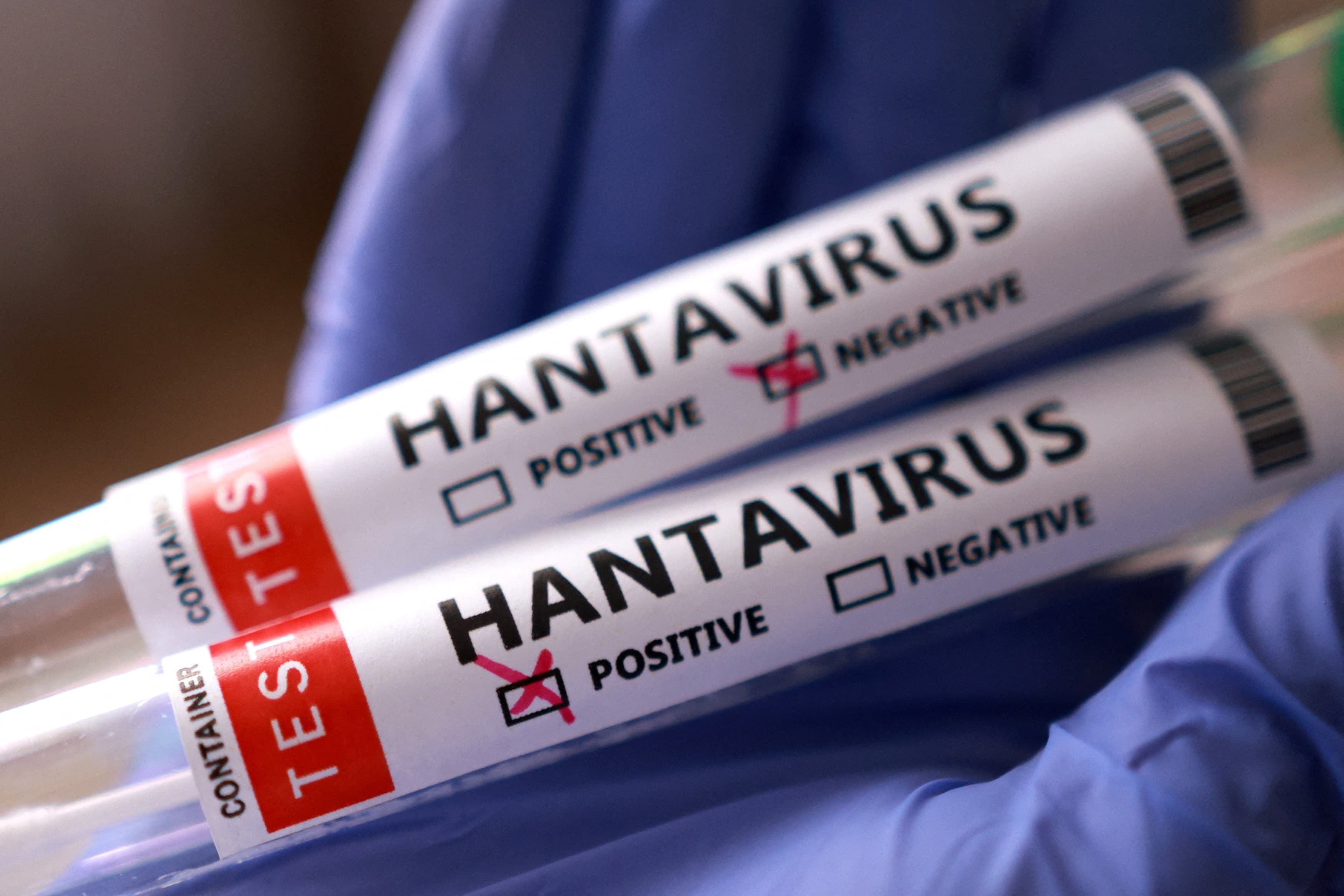 Singapore Tests Two Residents for Hantavirus After Cruise Outbreak